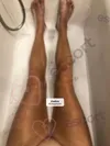 Zdjęcie 1